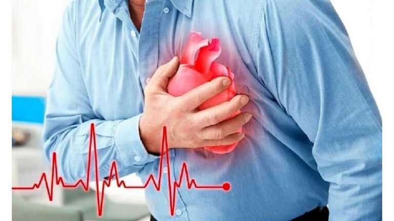 Nhồi máu cơ tim